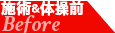 施術前