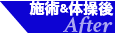 施術後